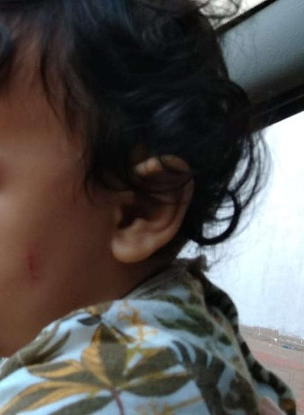 CrianÃ§a ficou com um machucado no rosto apÃ³s ter arma apontada durante assalto â Foto: Arquivo pessoal