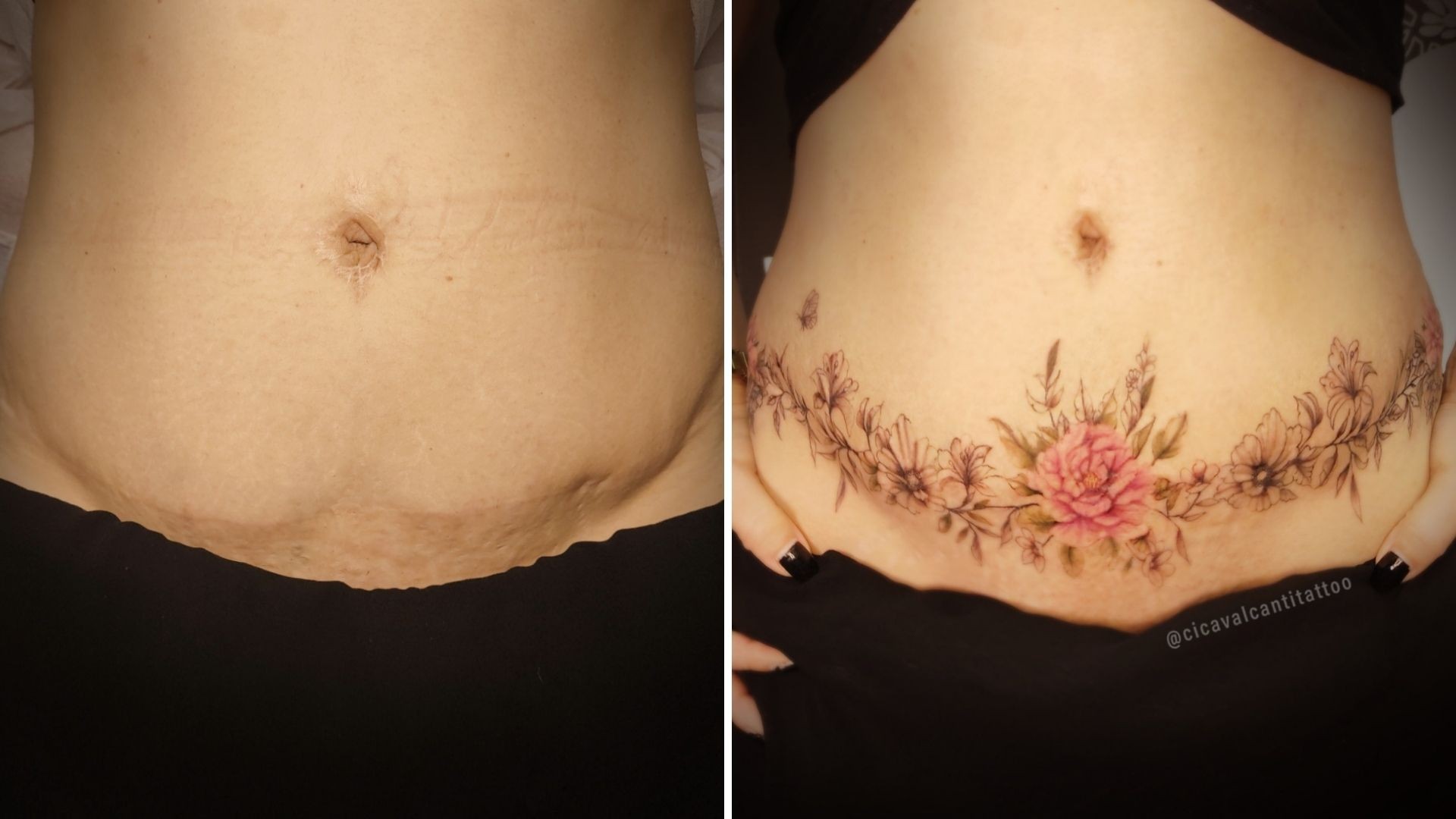 Tatuadora usa desenhos para cobrir cicatrizes de mulheres: 'Resgate da autoestima'