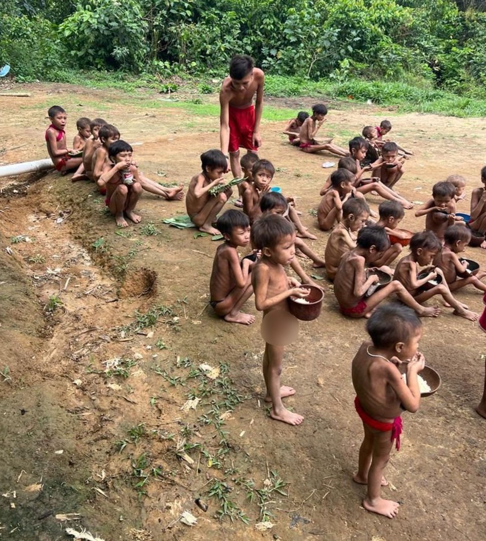 Crianças yanomami com desnutrição na região de Surucucu, na Terra Yanomami — Foto: Reprodução/Instagram/urihiyanomami