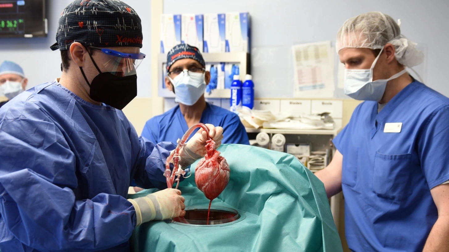 Cirurgiões da Universidade de Maryland preparam um coração de porco para um transplante em um humano (Foto: Faculdade de Medicina da Universidade de Maryland )