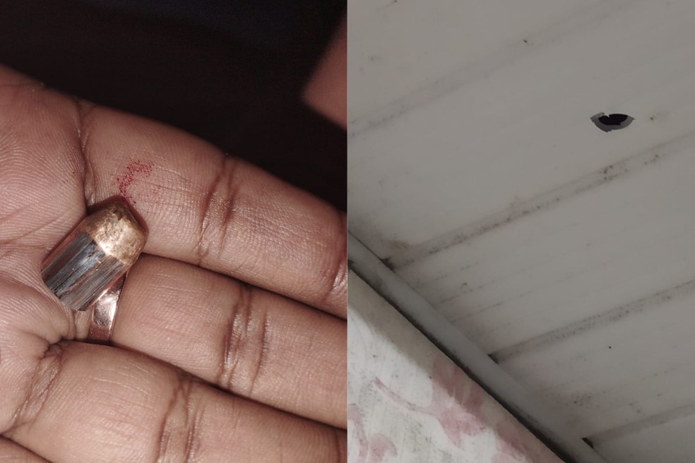 Mulher foi atingida por tiro na nádega enquanto assistia TV deitada no sofá da casa dela em Guarujá, SP — Foto: Arquivo Pessoal