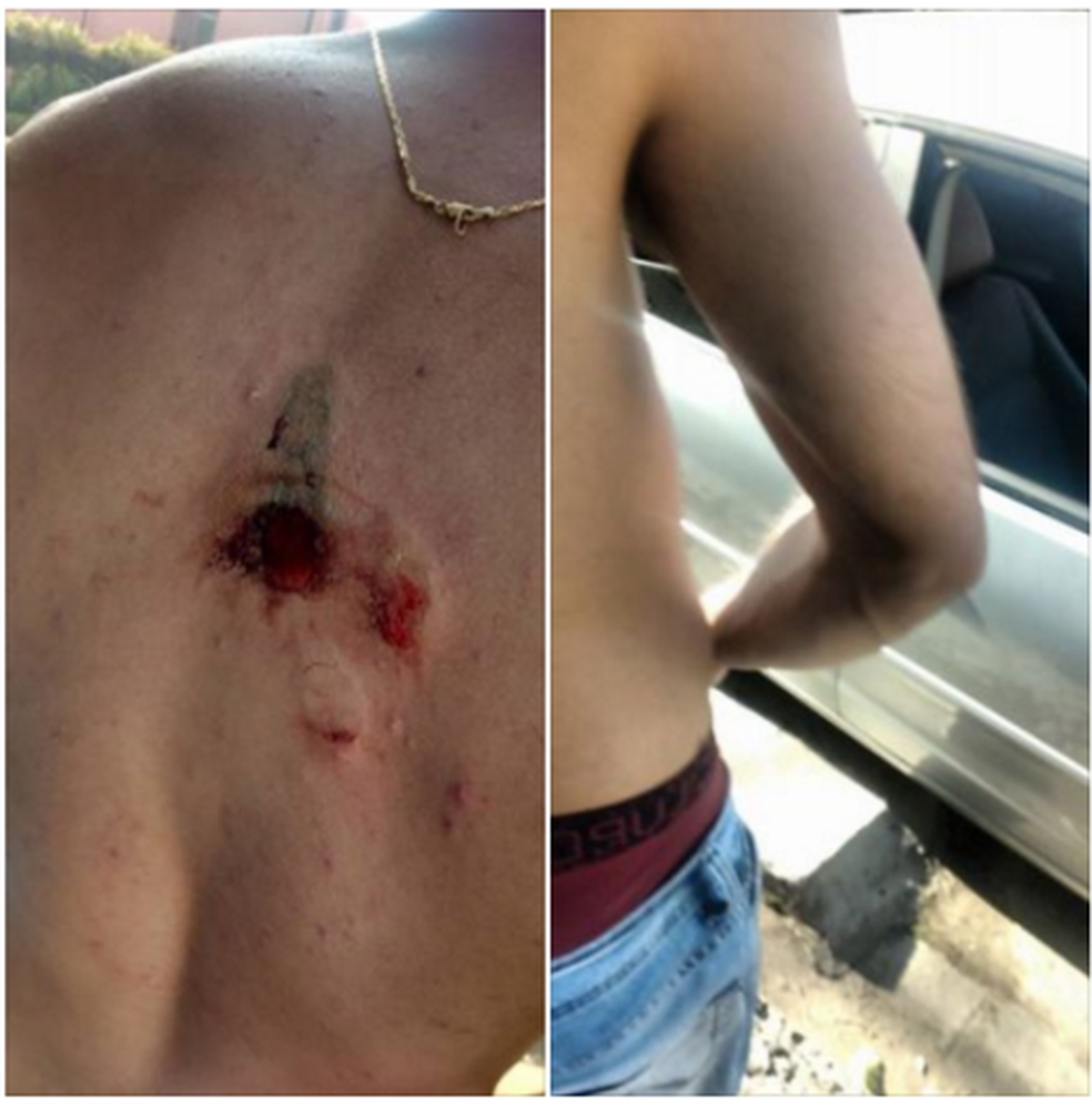 Jovem levou bala de borracha ans costas em fluxo na zona leste de SP (Foto: Reprodução/Facebook)