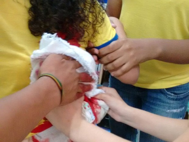 Estudante é atingida durante invasão em escola em São Luís