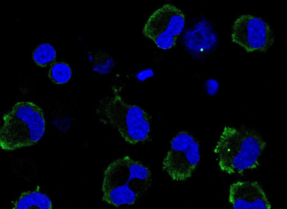 Imunofluorescência de inflamassomas ativos em macrófagos infectados pelo SARS-CoV-2. A proteína ASC, que faz parte dos inflamassomas, está corada em verde. Os núcleos dos macrófagos estão corados em azul  (Foto: Leticia Almeida e Keyla Sá/USP)