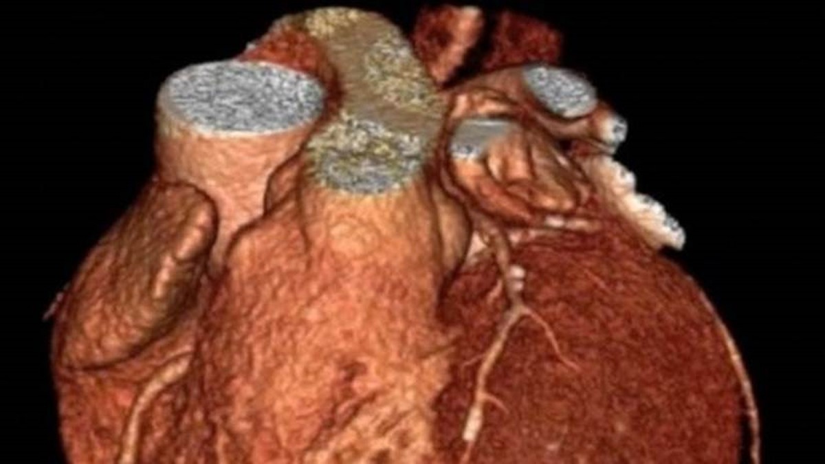 O Gene Perdido Que Faz Com Que Humanos Sejam Unica Especie Com Ataques Cardiacos Ciencia E Saude G1 ¿tienes una imagen cuyo tamaño de archivo es demasiado grande? o gene perdido que faz com que humanos