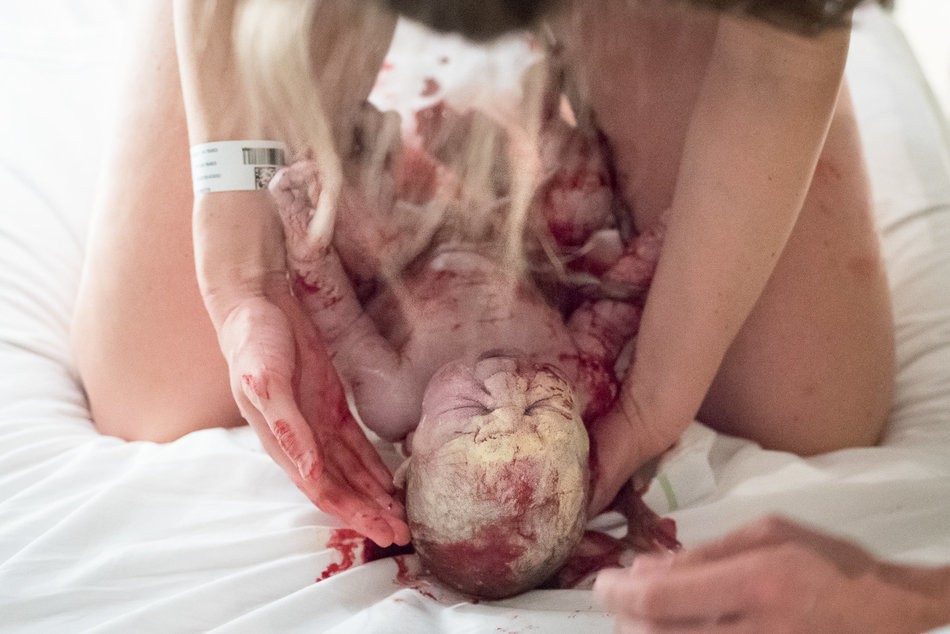 Foto premiada pelo concurso Birth Becomes Her  (Foto: Marijke Thoen)