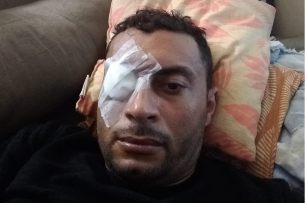 Eletricista sofre com lente e íris solta no olho, e espera há três anos em fila por cirurgia ocular no Ceará. — Foto: Reprodução