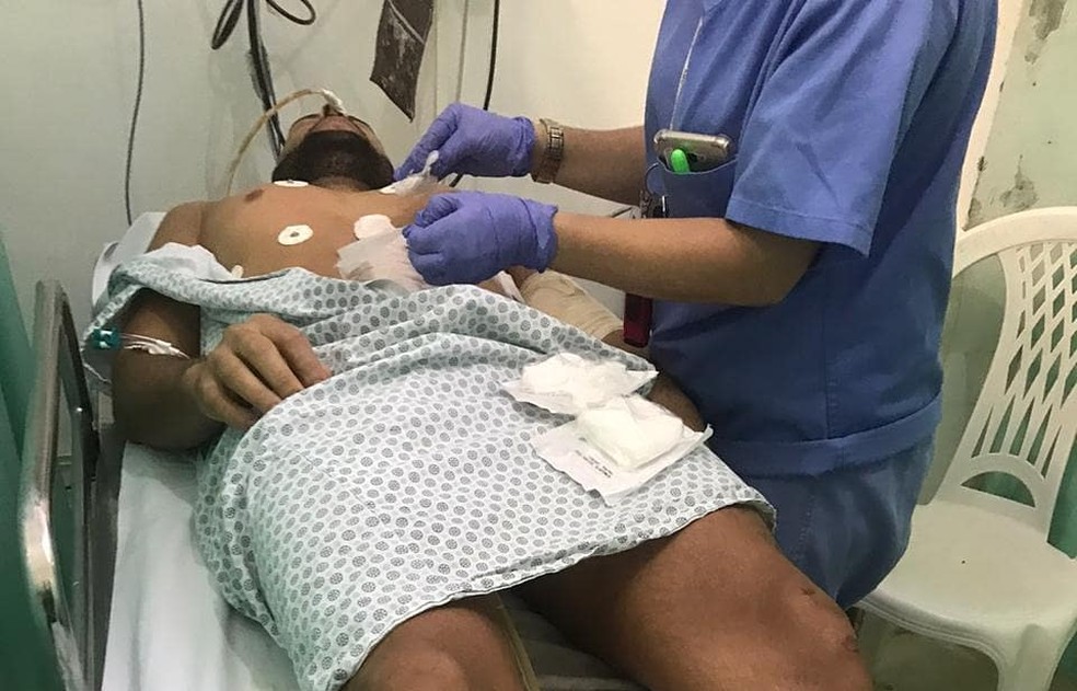 Vítima de homofobia, Marcelo Macedo foi agredido e baleado em um bar na Bahia — Foto: Reprodução/Instagram