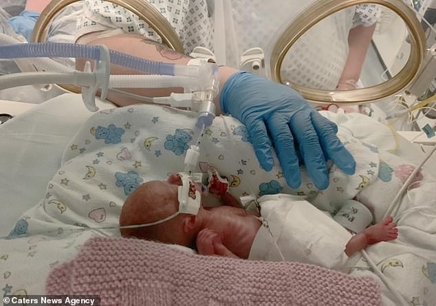 bebê nasceu pesando 490 gramas (Foto: Reprodução/Daily Mail)