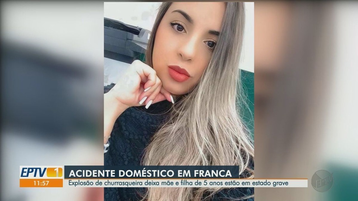 Une mère et sa fille de 5 ans subissent de graves brûlures après l’explosion d’un barbecue à Franca, SP |  Ribeirao Preto et Franca