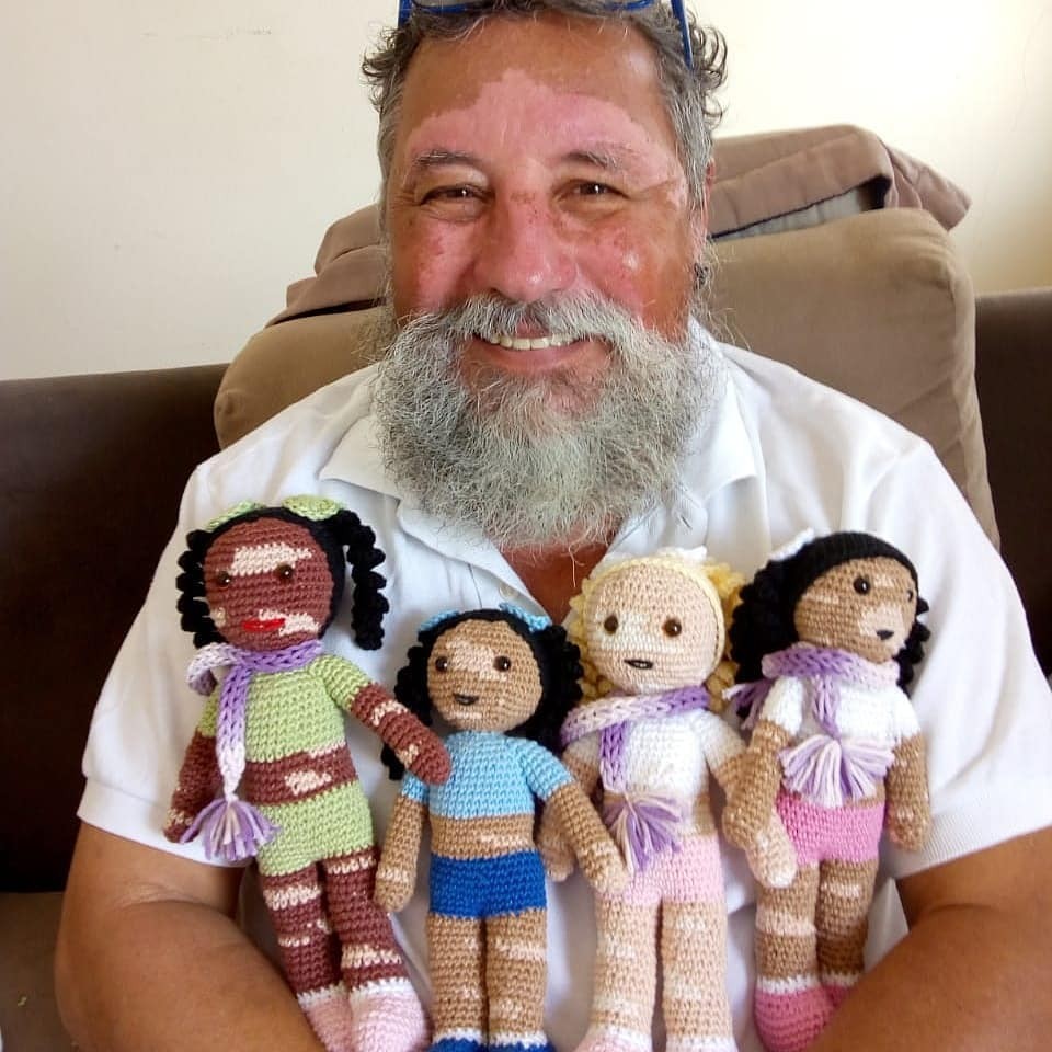 Vovô com vitiligo faz bonecos de crochê para crianças com a condição crônica (Foto: Reprodução)