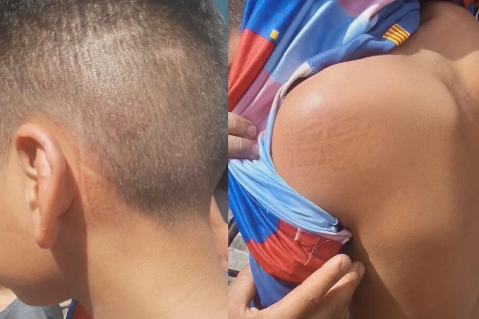 Fotos mostram marcas de tênis em adolescente agredido por homem no DF — Foto: Arquivo pessoal