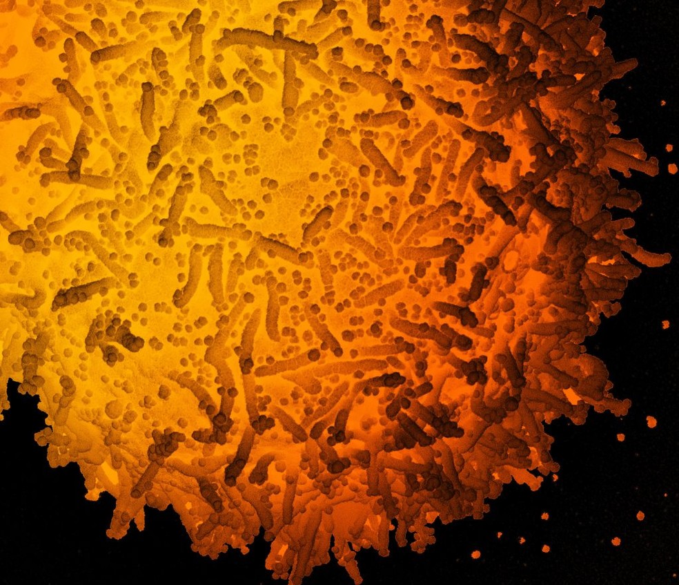 Micrografia eletrônica de varredura com cores aprimoradas de uma célula infectada com partículas de SARS-CoV-2, isolada de uma amostra de paciente.  — Foto: NIAID