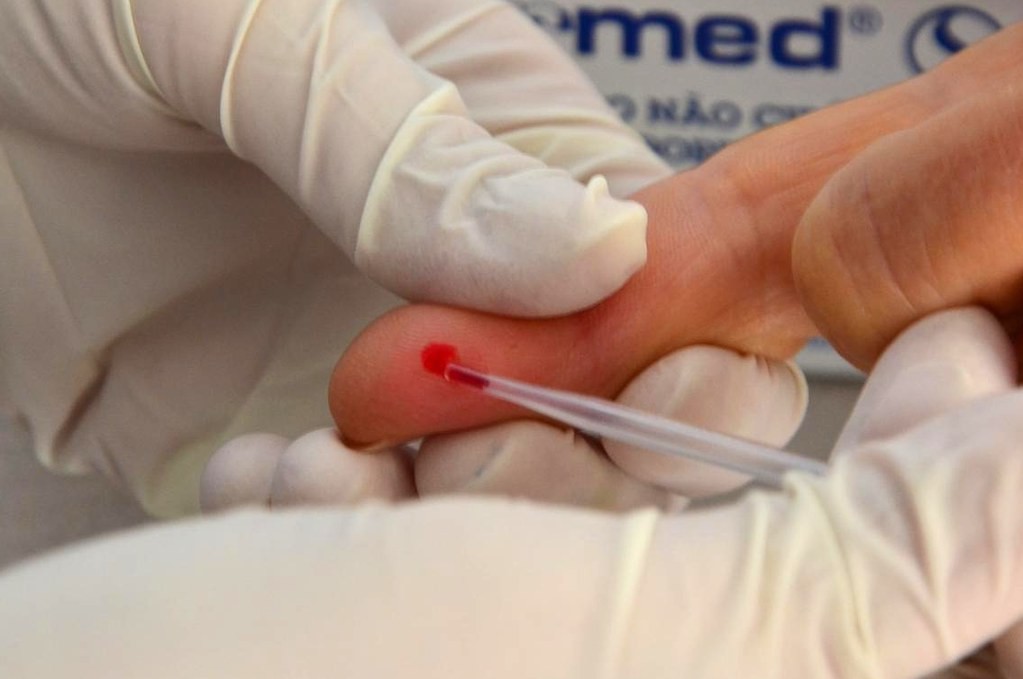 Manter os exames em dia é essencial na prevenção contra hepatite (Foto: Flickr/Prefeitura de Votuporanga, SP)