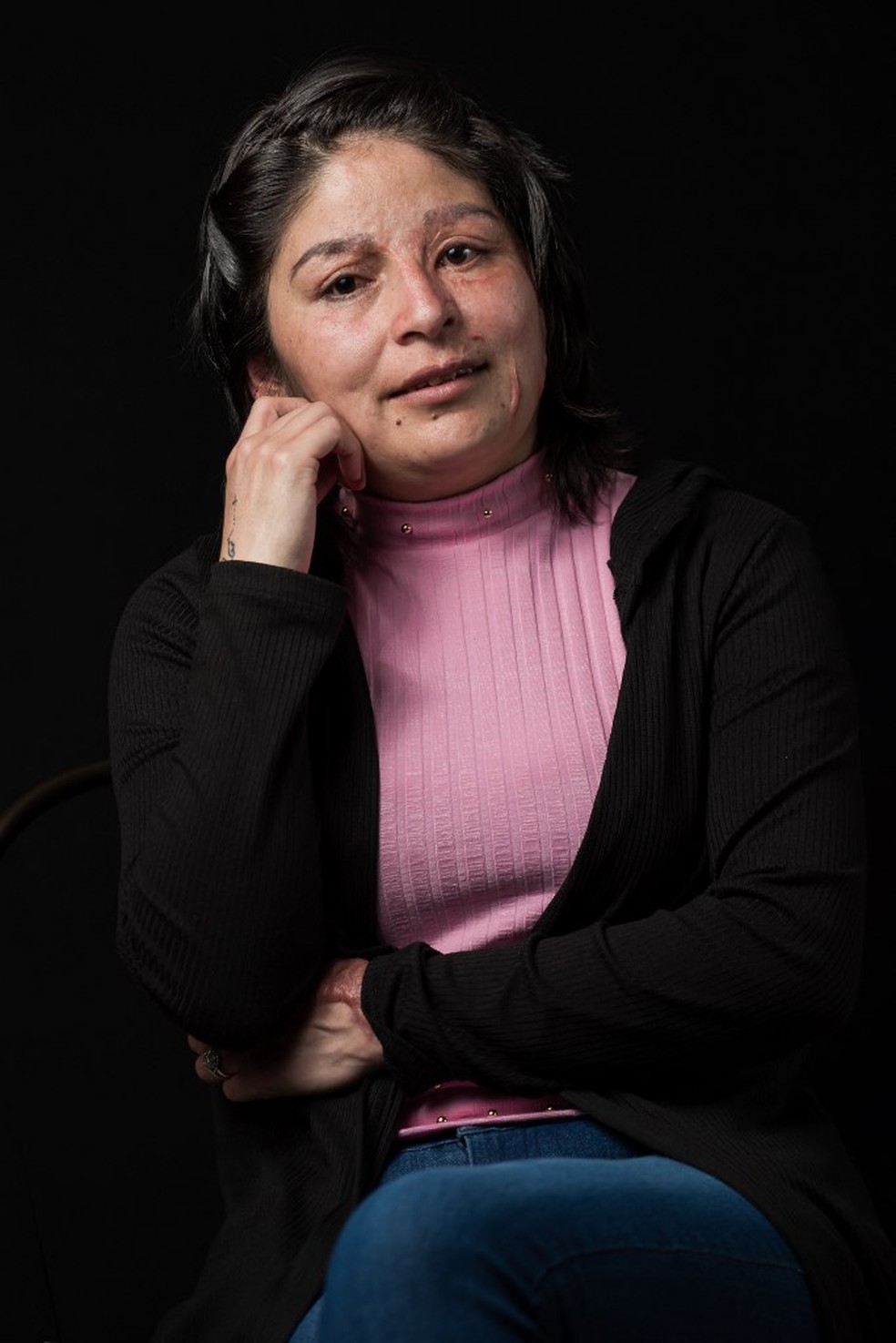 Yazm&iacute;n foi atacada com &aacute;cido no rosto &mdash; Foto: Omar Torres/AFP