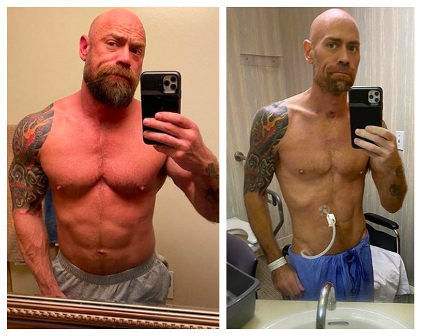 O enfermeiro Mike Schultz antes e depois de ser diagnosticado com COVID-19 (Foto: Instagram)