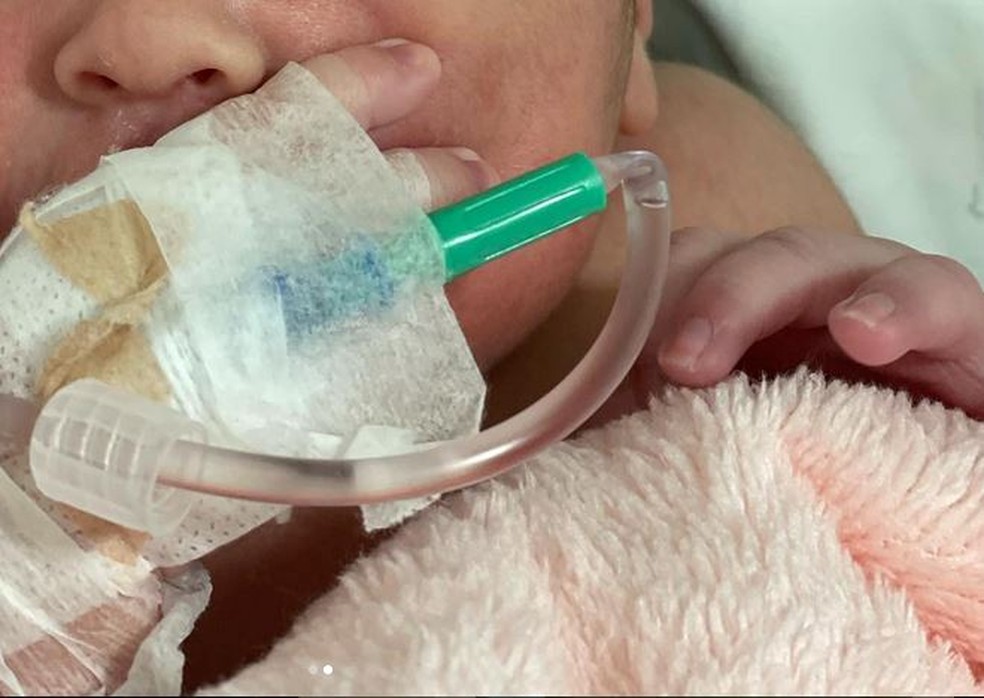 Bebê teve traumatismo craniano após nascer em BH — Foto: Arquivo pessoal