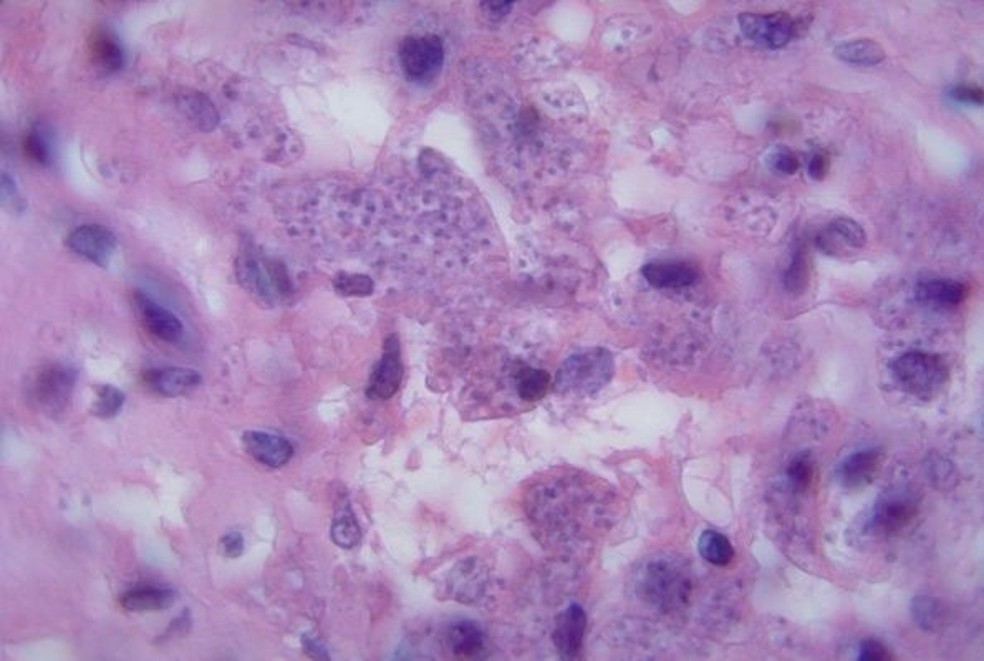 O parasita causador da leishmaniose visto do microscópio — Foto: BBC