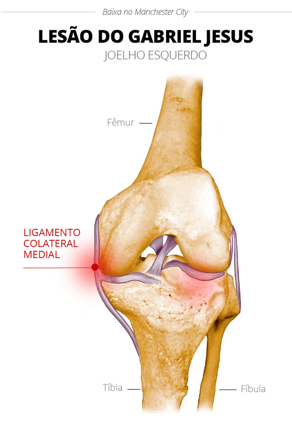 Detalhe do local da lesão de Gabriel Jesus (Foto: Infoesporte)