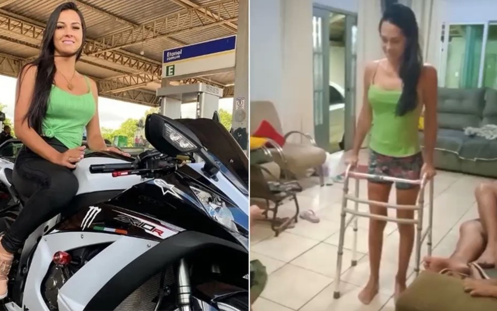 Leidiane Rodrigues Nazário antes e depoi de ser atropelada ao interromper agressão, em Goiânia, Goiás — Foto: Leidiane Rodrigues/Arquivo Pessoal