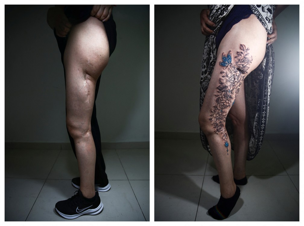 Valéria Festa participou do projeto 'We Are Diamonds' e fez tatuagens em cima das cicatrizes de um acidente de carro — Foto: Reuters/Carla Carniel