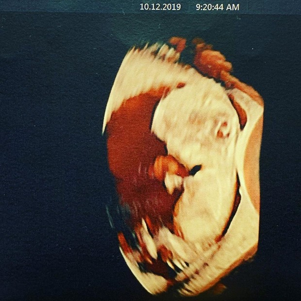 Mayana Moura mostra ultrassom (Foto: Reprodução/Instagram)