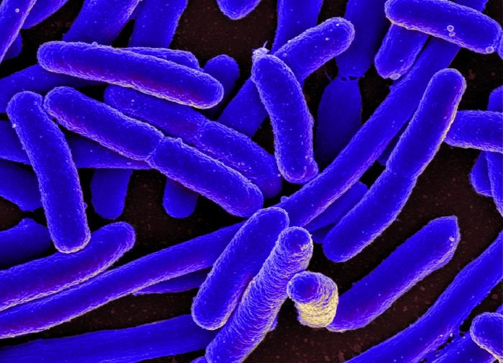Escherichia coli, bactéria comum no organismo humano e normalmente inofensiva  (Foto: NIH - National Institute of Health)