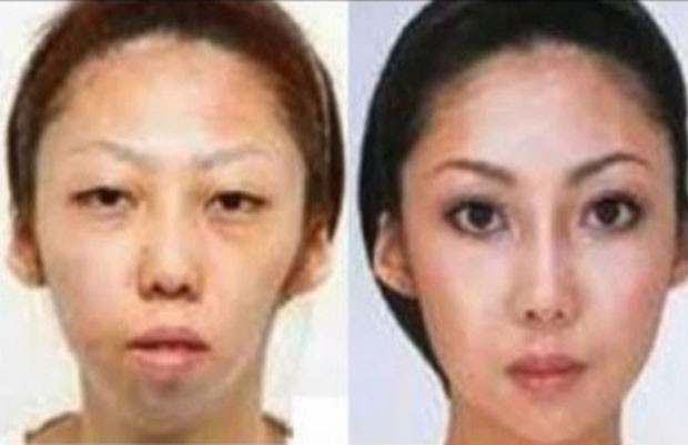 Chinês processou a esposa após descobrir que ela havia feito plástica. (Foto: Reprodução)