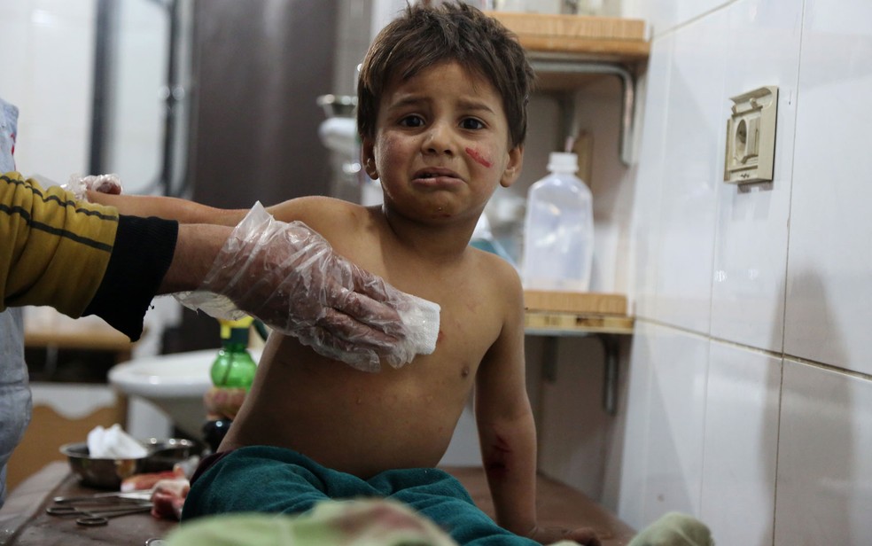 Mohammed chora ao ser socorrido em hospital improvisado em Kafr Batna após ser ferido, junto com sua mãe, em bombardeio em Jisreen, na região de Guta Oriental, na segunda-feira (19) (Foto: Ammar Suleiman/AFP)