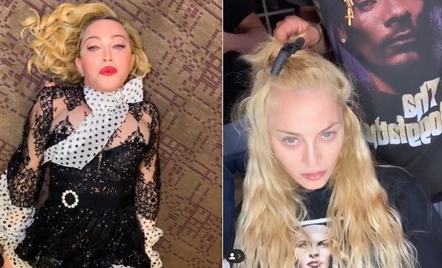 Madonna; antes e depois (Foto: Instagram/ Reprodução)