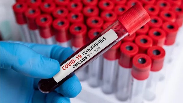 sangue, exame, amostra, covid-19, coronavírus, laboratório, mão, luva, azul (Foto: GETTY IMAGES)