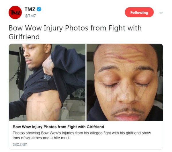 Bow Wow exibe marcas das agressões (Foto: Reprodução Twitter)