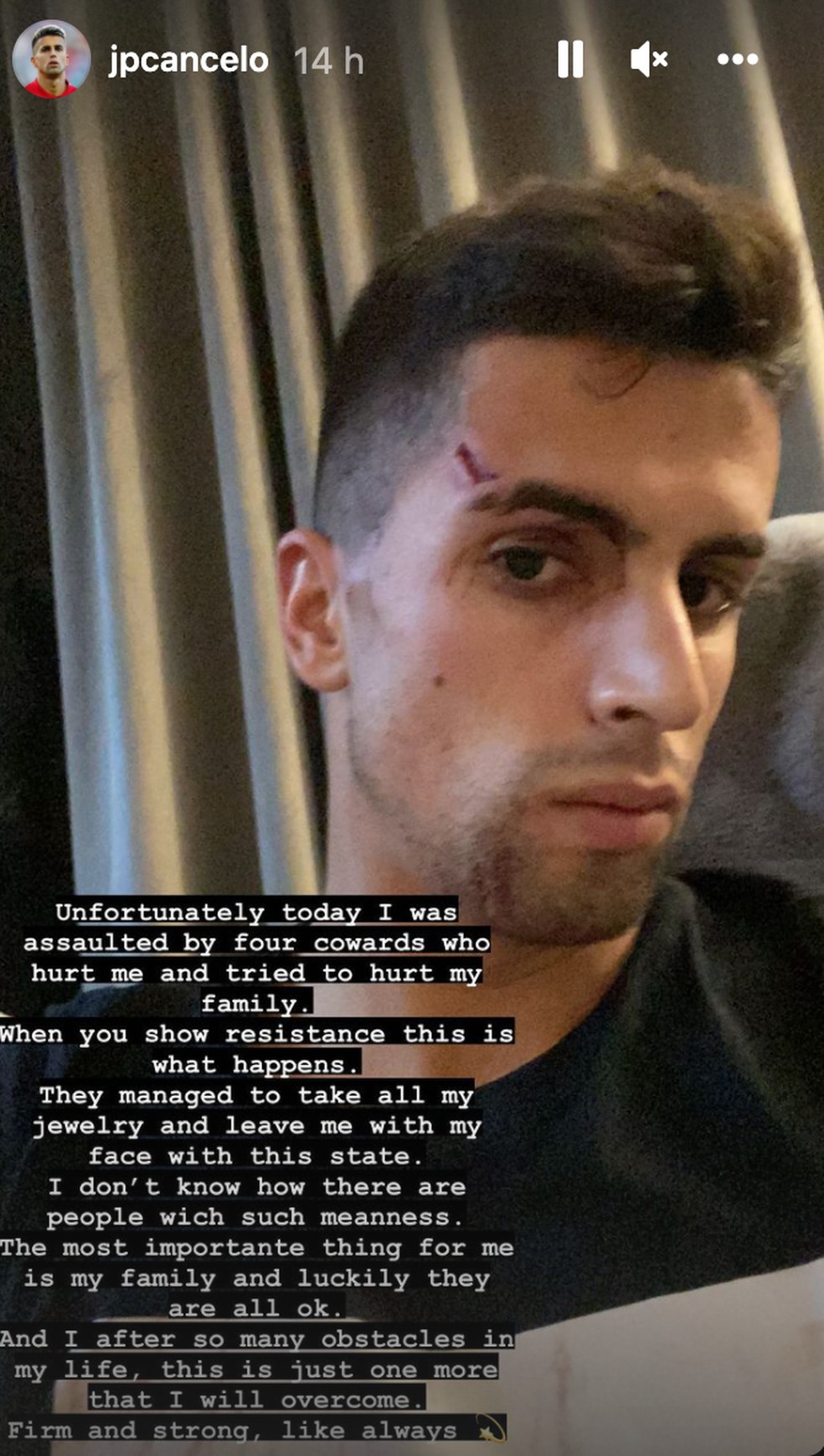 Imagem publicada por João Cancelo mostra ferimento que, segundo ele, foi causado por criminosos que entraram na casa dele — Foto: Reprodução/Instagram