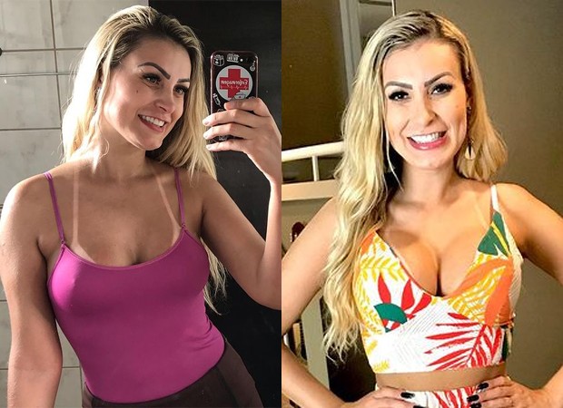 Andressa Urach antes e depois de trocar próteses de silicone (Foto: Reprodução/Instagram)