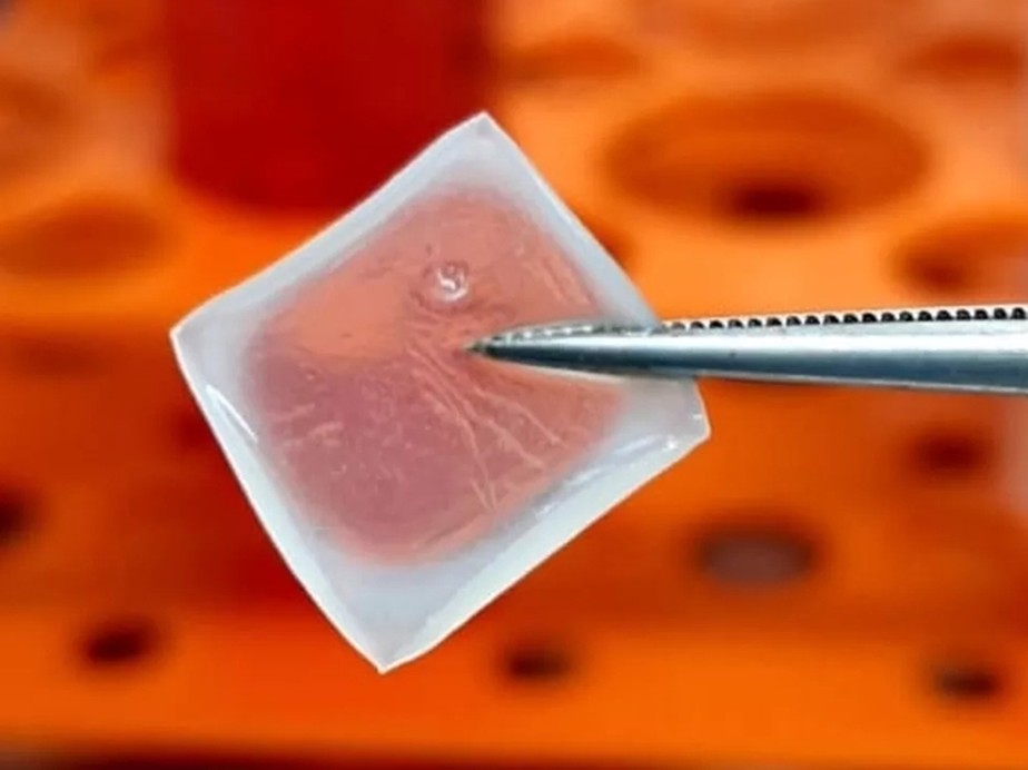 Produto feito com células derivadas do cordão umbilical humano foi produzido em impressora 3D pela startup In Situ Cell Therapy