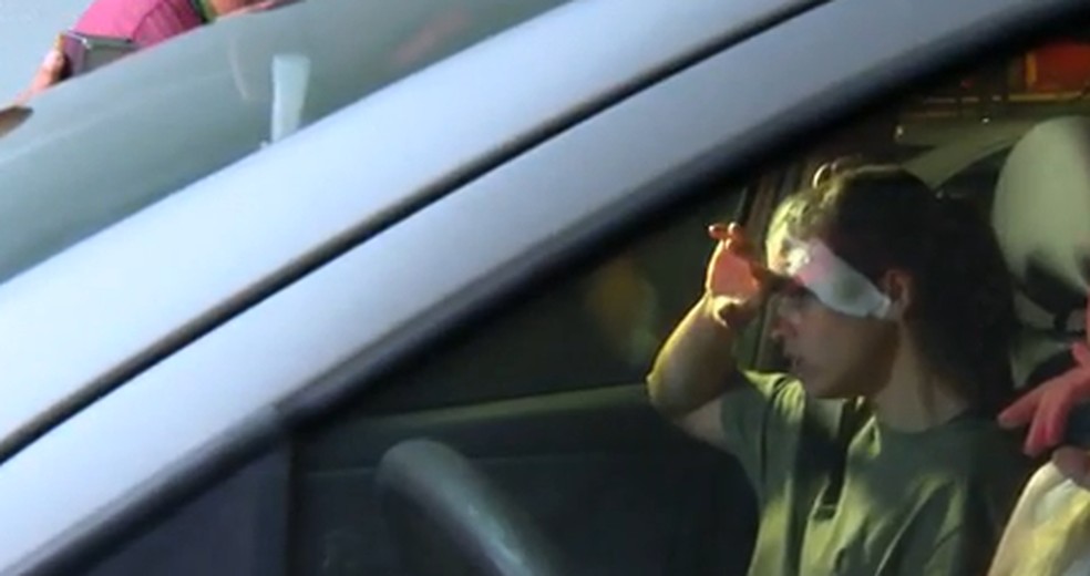 Agente da Polícia Federal ferida durante ataque de Roberto Jefferson  — Foto: Reprodução