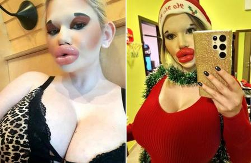 Andrea Ivanova, dona dos 'maiores l&aacute;bios do mundo' &mdash; Foto: Reprodu&ccedil;&atilde;o