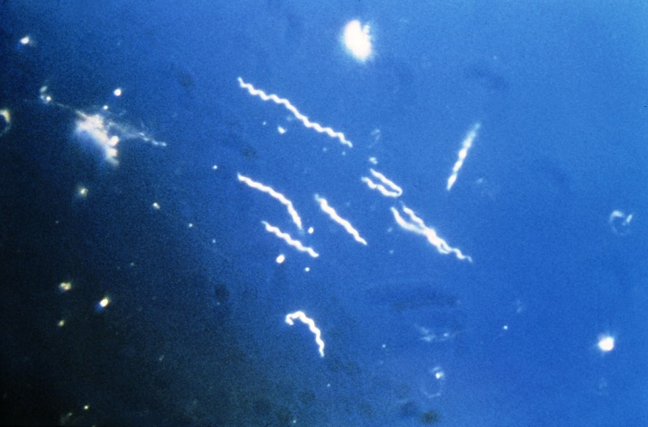 Bactéria Borrelia burgdorferi, causadora da doença de Lyme (Foto: Wikimedia Commons )