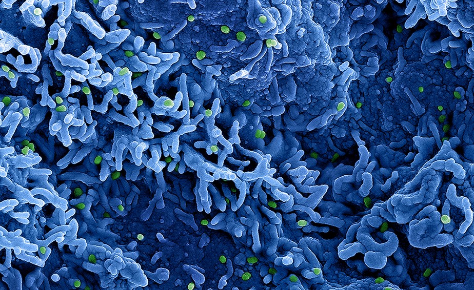 Partículas do vírus da varíola dos macacos (verde) encontradas dentro do tecido de uma célula infectada (azul).