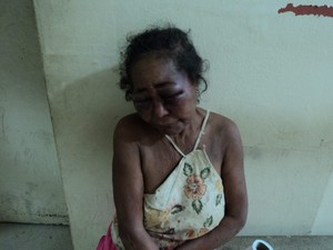 Maria de Lourdes, 55 anos teria sido agredida e violentada pelo próprio filho. (Foto: Luiz Sandes)