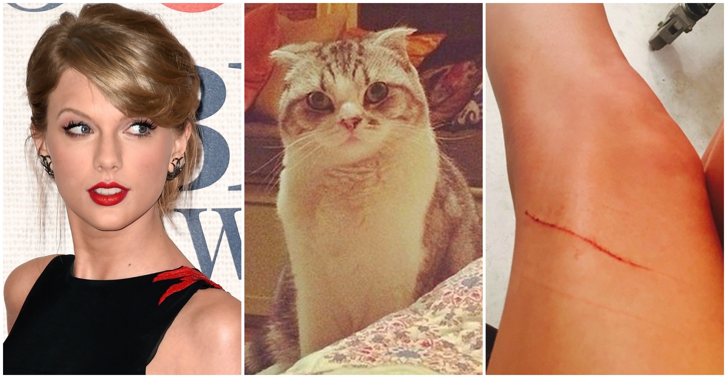 Taylor Swift, sua gata Meredith e o arranhão. (Foto: Getty Images e Instagram)