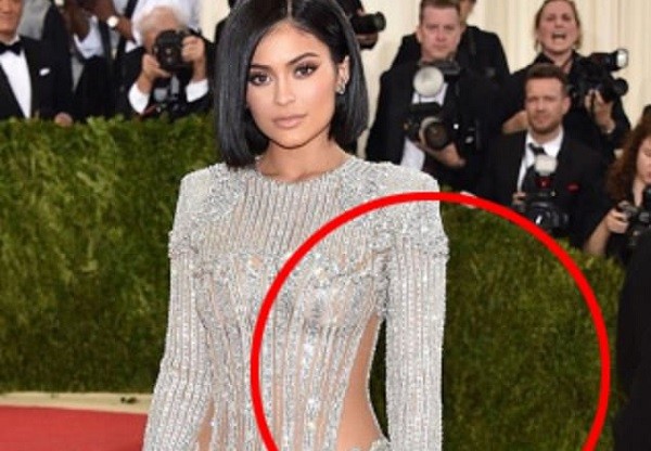 Fã aponta edição no Photoshop feita para Kylie Jenner ficar com o braço menor (Foto: Instagram)