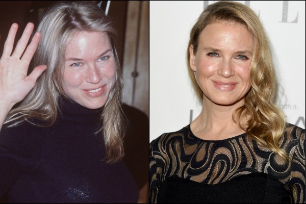 A transformação do rosto da atriz Renée Zellweger ao longo dos anos (Foto: Getty Images)