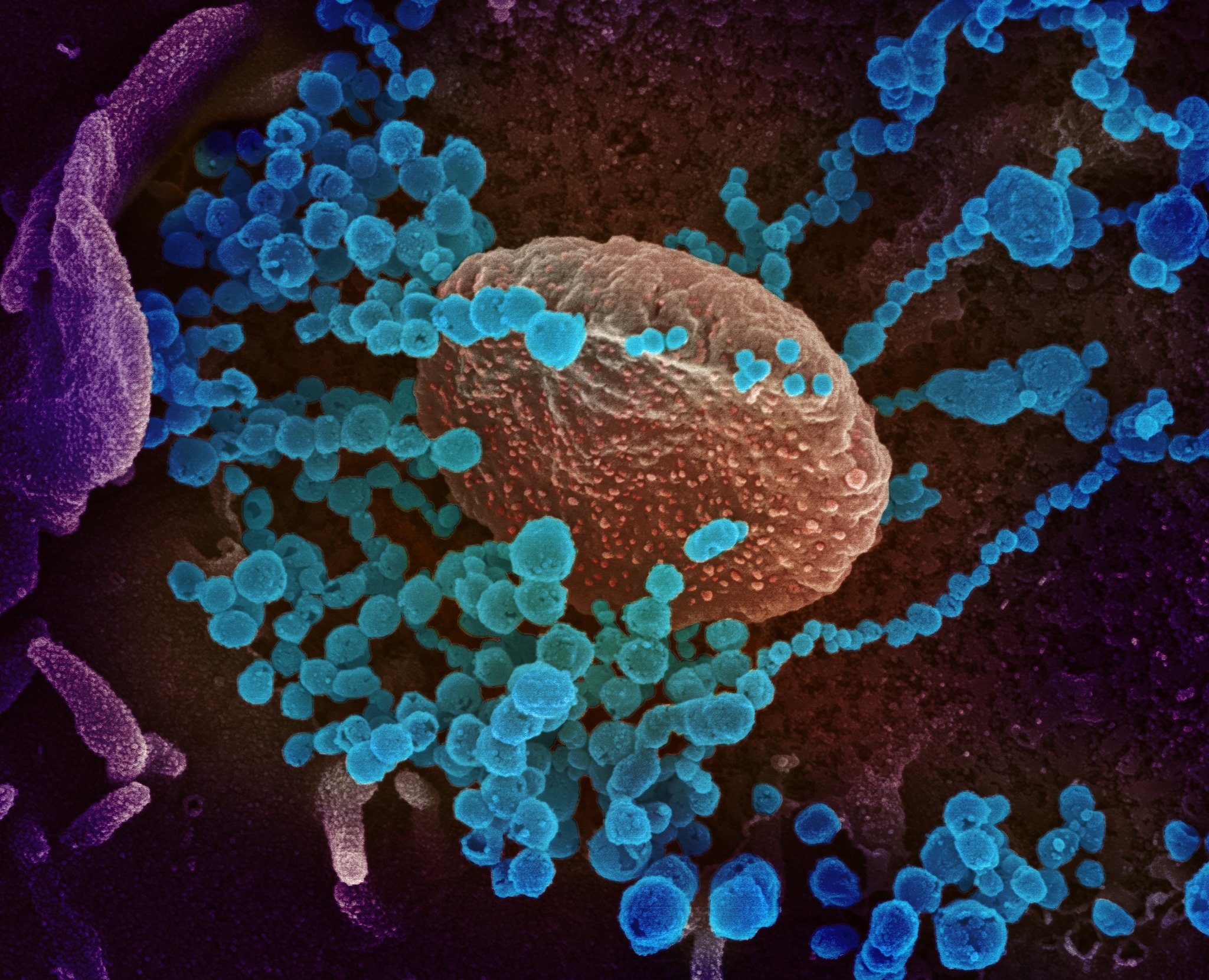 Imagem de microscópio eletrônico de varredura mostra Sars-CoV-2 emergindo da superfície de células cultivadas em laboratório (Foto: NIAID)