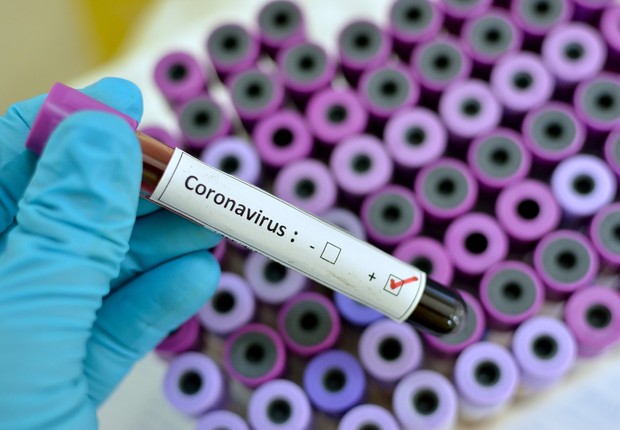 Teste positivo do coronavírus (Foto: iStock / Getty Images Plus)