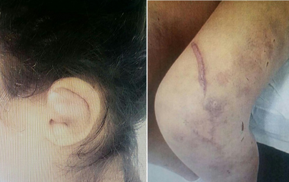 Jovem tinha marcas de agressão em todo o corpo (Foto: Polícia Civil/Divulgação)