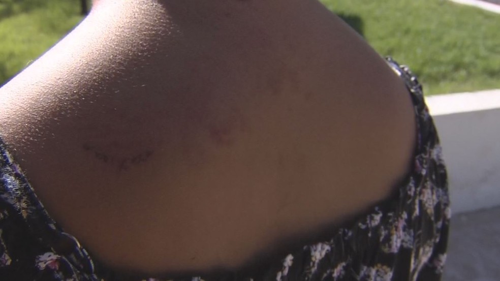 Menina foi agredida pelo padrasto em Araçatuba (SP) — Foto: Reprodução/TV TEM
