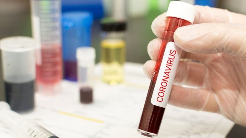 Para profissionais de saúde, aumento de casos e riscos de infecção têm aumentado estresse e pressão sobre profissionais — Foto: Getty Images/ BBC
