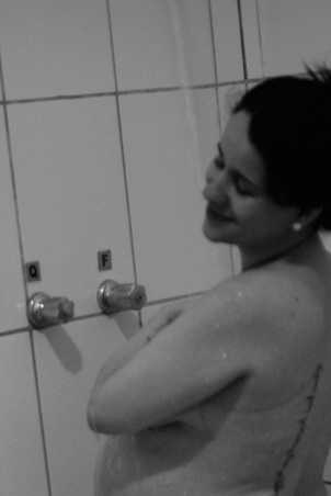 O chuveiro ajudava a aliviar a dor (Foto: Arquivo pessoal/ Marina Mamede)