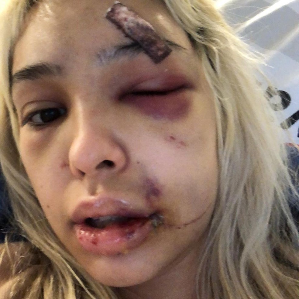 Rebeca Kodaira, brasileira de 22 anos, diz ter sido agredida pelo namorado na Alemanha â€” Foto: ReproduÃ§Ã£o / Facebook